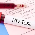 tes hiv untuk mengetahui berapa lama hiv bisa terdeteksi setelah berhubungan