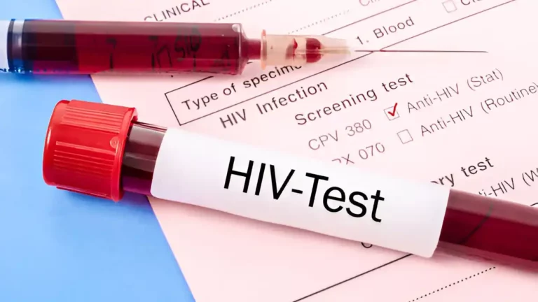 tes hiv untuk mengetahui berapa lama hiv bisa terdeteksi setelah berhubungan