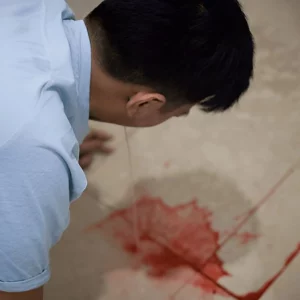Muntah darah karena GERD