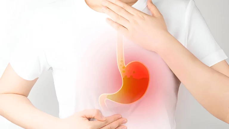 cara mengatasi nyeri ulu hati karena asam lambung