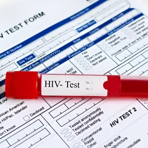 hasil tes hiv