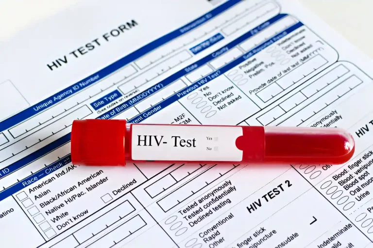 hasil tes hiv