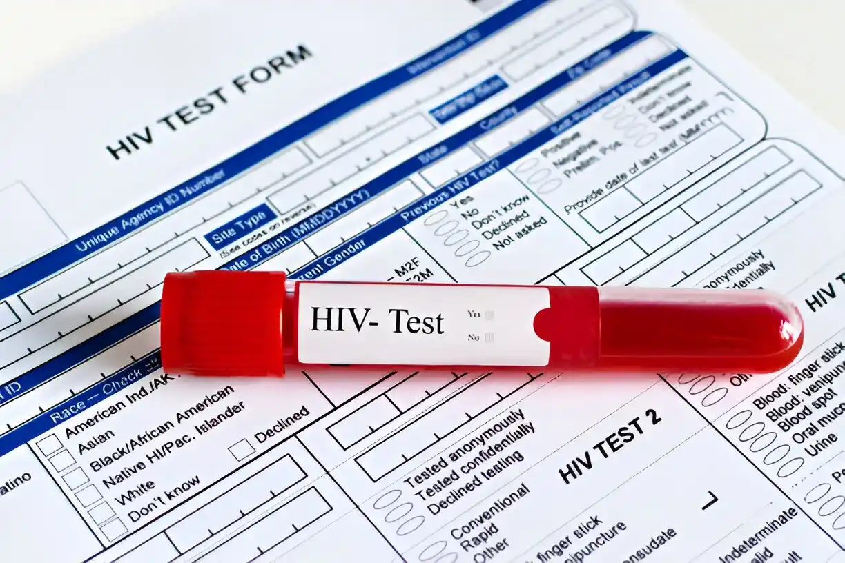 hasil tes hiv
